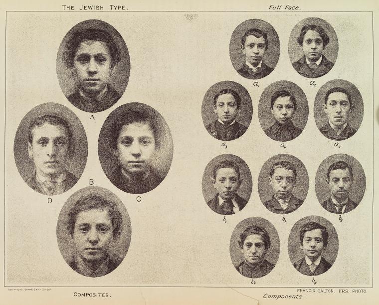 The Jewish type. Full face