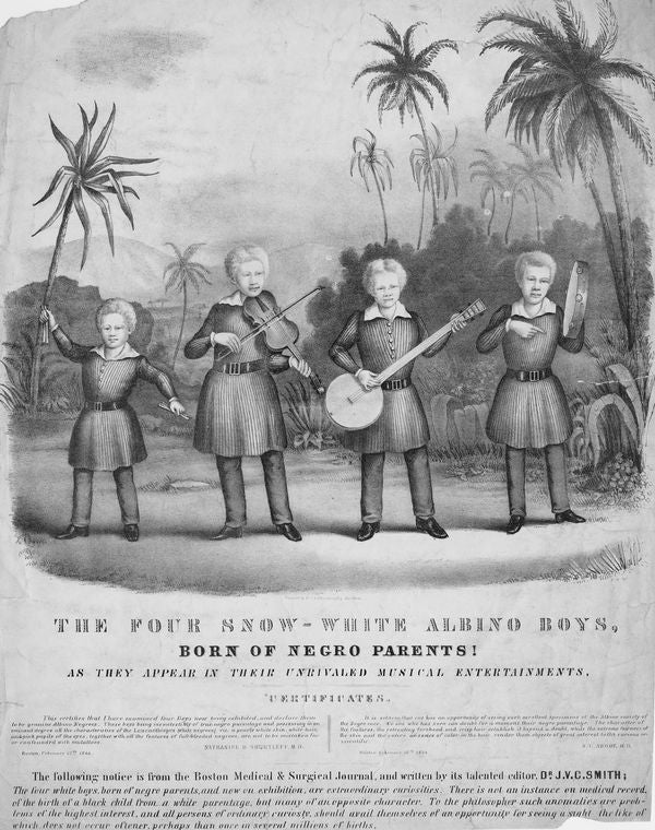 The four snow-white albino boys born of Negro parents!