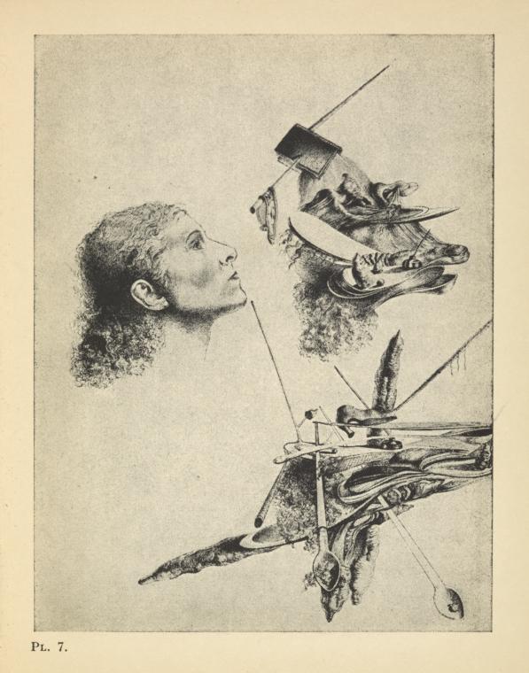 Paranoiac metamorphosis of Gala's face.