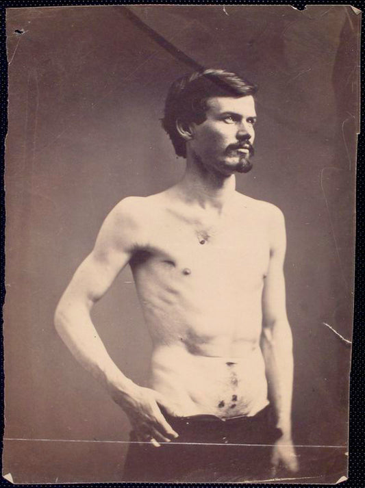 James Brownlee : Wounds in chest & abdomen [Three-quarter view, shirtless man standing, clothing adjusted to show gunshot wounds to chest and lower abdomen]