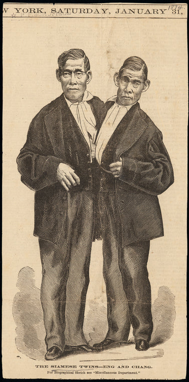 The Siamese Twins---Eng and Chang