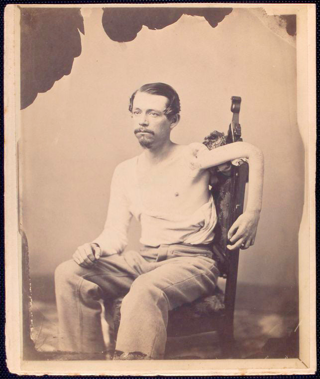 John F. Claghorn : 214 Gold St., Brooklyn L.I. [Man seated on chair, shirt partially removed to display wounded left arm resting over chair back]