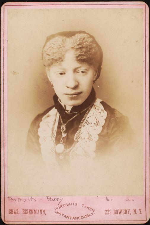Miss Perry, colored albina, Barnum Show