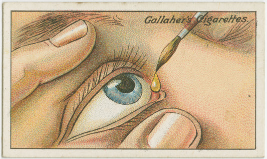 How to remove foreign particles from the eye.